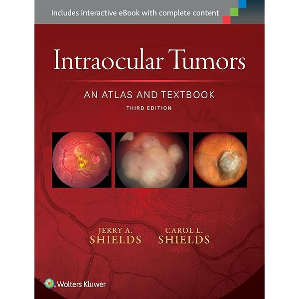 Ophthalmic Pathology: A Concise Guide: 9781461443933: Medicine